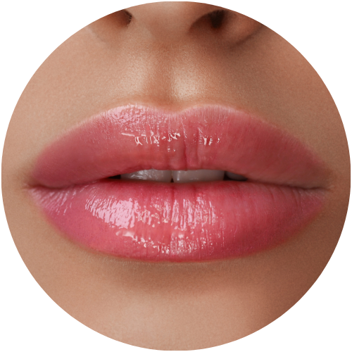 Labios